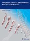 Peripheral Vascular Interventions: An Illustrated Manual - Book
