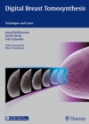 Digital Breast Tomosynthesis : Technique and Cases - Book