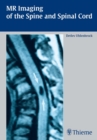 MR Imaging of the Spine and Spinal Cord - eBook
