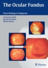 The Ocular Fundus : From Findings to Diagnosis - eBook
