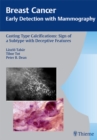Breast Cancer: Early Detection with Mammography : Casting-Type Calcifications: Sign of a Subtype with Deceptive Features - eBook