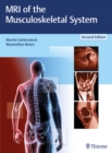 MRI of the Musculoskeletal System - eBook
