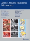Atlas of Acoustic Neurinoma Microsurgery - eBook