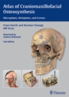 Atlas of Craniomaxillofacial Osteosynthesis : Microplates, Miniplates, and Screws - eBook