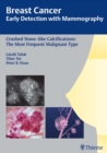Breast Cancer: Early Detection with Mammography : Crushed Stone-like Calcifications: The Most Frequent Malignant Type - eBook