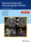 Neurosonology and Neuroimaging of Stroke : A Comprehensive Reference - eBook