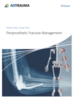 Periprosthetic Fracture Management - eBook