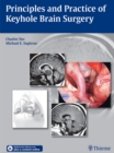 Principles and Practice of Keyhole Brain Surgery - eBook