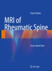 MRI of Rheumatic Spine : A Case-Based Atlas - eBook