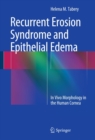 Recurrent Erosion Syndrome and Epithelial Edema : In Vivo Morphology in the Human Cornea - eBook