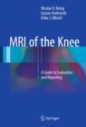 MRI of the Knee : A Guide to Evaluation and Reporting - eBook
