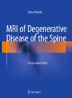 MRI of Degenerative Disease of the Spine : A Case-Based Atlas - eBook