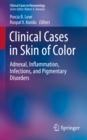 Clinical Cases in Skin of Color : Adnexal, Inflammation, Infections, and Pigmentary Disorders - eBook