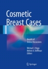 Cosmetic Breast Cases : Results of Online Discussions - eBook