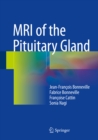 MRI of the Pituitary Gland - eBook