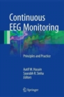 Continuous EEG Monitoring : Principles and Practice - Book