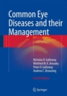 Common Eye Diseases and their Management - Book