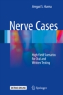Nerve Cases : High Yield Scenarios for Oral and Written Testing - eBook