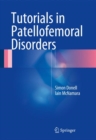 Tutorials in Patellofemoral Disorders - eBook
