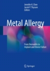 Metal Allergy : From Dermatitis to Implant and Device Failure - Book