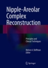 Nipple-Areolar Complex Reconstruction : Principles and Clinical Techniques - eBook