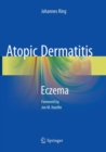 Atopic Dermatitis : Eczema - Book