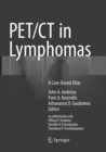 PET/CT in Lymphomas : A Case-Based Atlas - Book