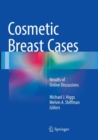 Cosmetic Breast Cases : Results of Online Discussions - Book