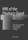 MRI of the Pituitary Gland - Book