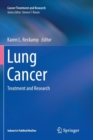 Lung Cancer : Treatment and Research - Book