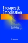 Therapeutic Embolization - Book