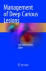 Management of Deep Carious Lesions - Book