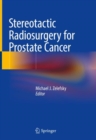 Stereotactic Radiosurgery for Prostate Cancer - Book