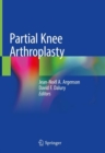 Partial Knee Arthroplasty - eBook