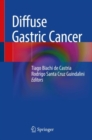 Diffuse Gastric Cancer - eBook