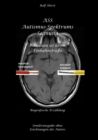 ASS Autismus-Spektrums-Segnung - Inklusion ist keine Einbahnstrae: hochfunktionaler Autismus, Mobbing, Trauma, Sucht, Hausliche Gewalt, Psychotherapie, Umzug, Inklusion, Katholische Kirche, Zen : Sond - eBook