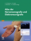 Atlas der Nervensonografie und Elektroneurografie - eBook