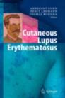 Cutaneous Lupus Erythematosus - eBook