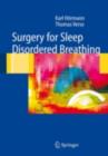 Surgery for Sleep-Disordered Breathing - eBook