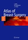 Atlas of Breast Surgery - eBook