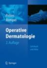 Operative Dermatologie : Lehrbuch und Atlas - eBook