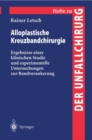 Alloplastische Kreuzbandchirurgie - Book