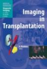 Imaging in Transplantation - eBook