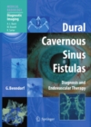Dural Cavernous Sinus Fistulas : Diagnosis and Endovascular Therapy - eBook