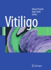 Vitiligo - eBook