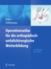 Operationsatlas fur die orthopadisch-unfallchirurgische Weiterbildung - eBook