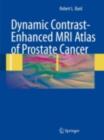 Dynamic Contrast-Enhanced MRI Atlas of Prostate Cancer - eBook