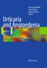 Urticaria and Angioedema - eBook