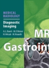 MRI of the Gastrointestinal Tract - eBook