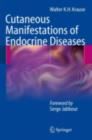 Cutaneous Manifestations of Endocrine Diseases - eBook